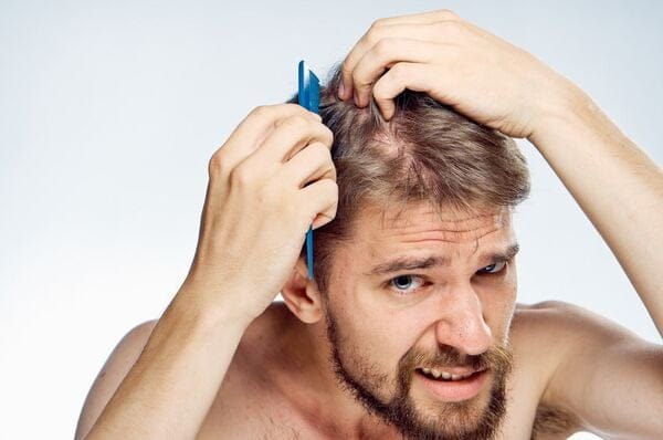 Top 11 sản phẩm giảm rụng tóc cho nam giới được yêu thích nhất 2022