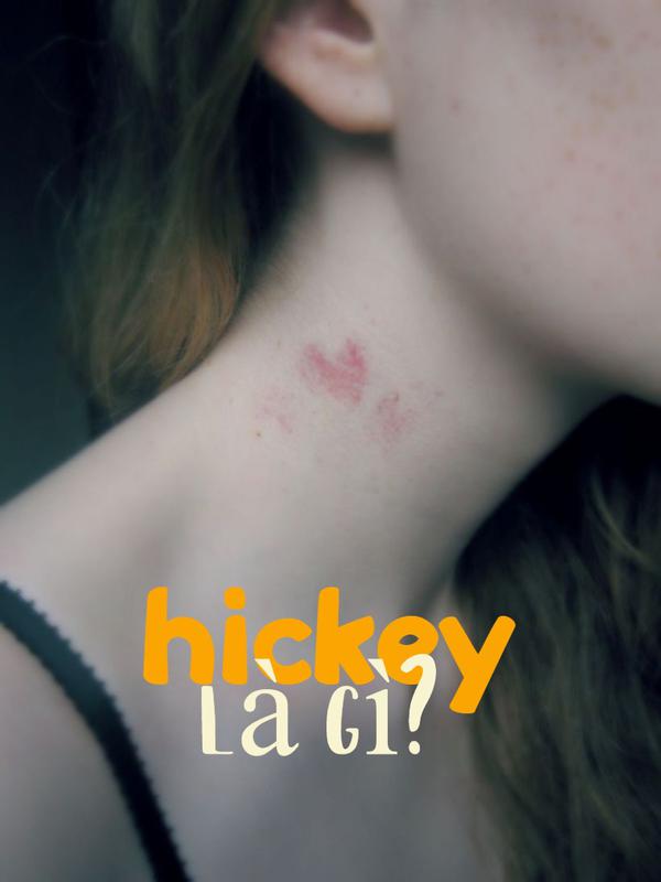 Hickey là gì ? Cách đánh dấu chủ quyền bằng dấu hickey đúng cách